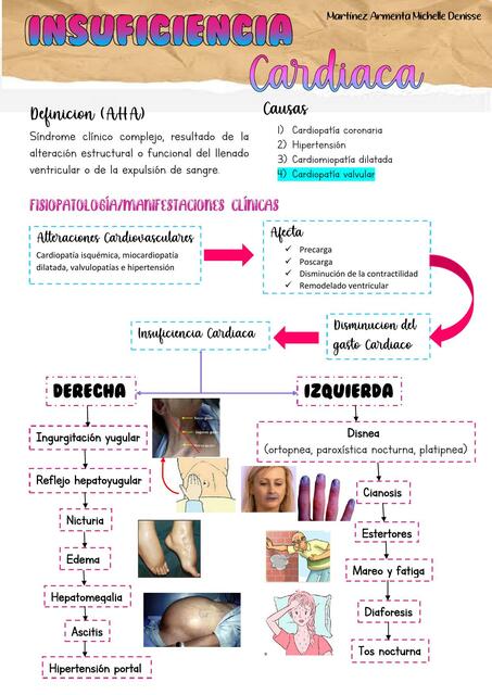 Insuficiencia Cardiaca 