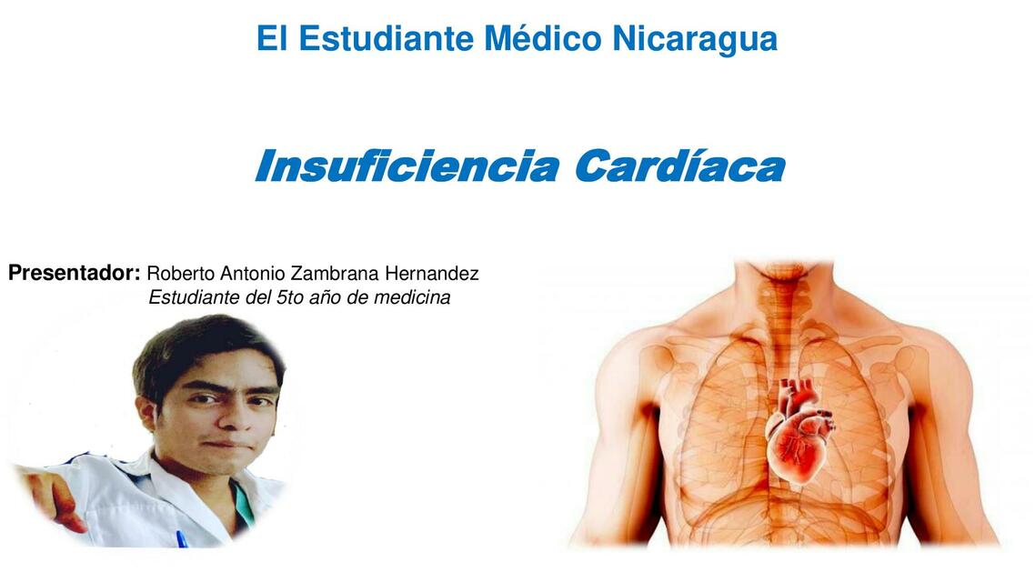 Insuficiencia Cardíaca