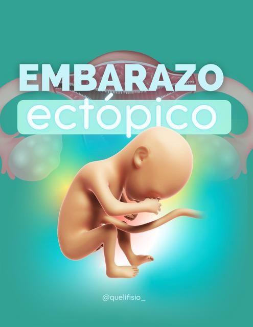 Embarazo ectopico