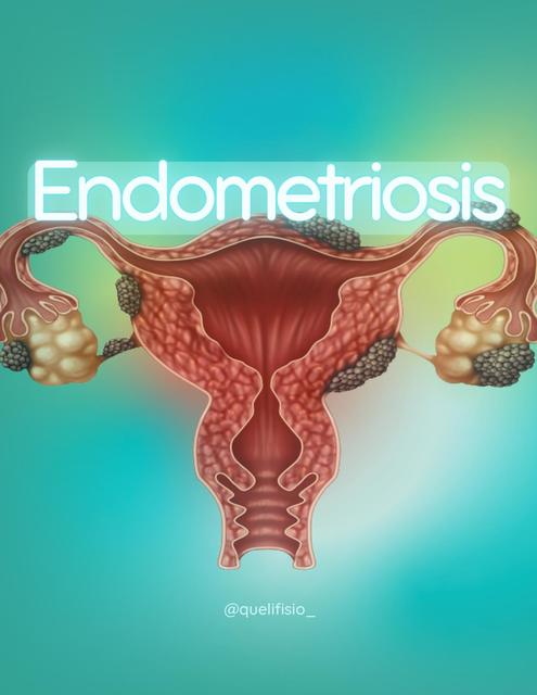 Endometriosis