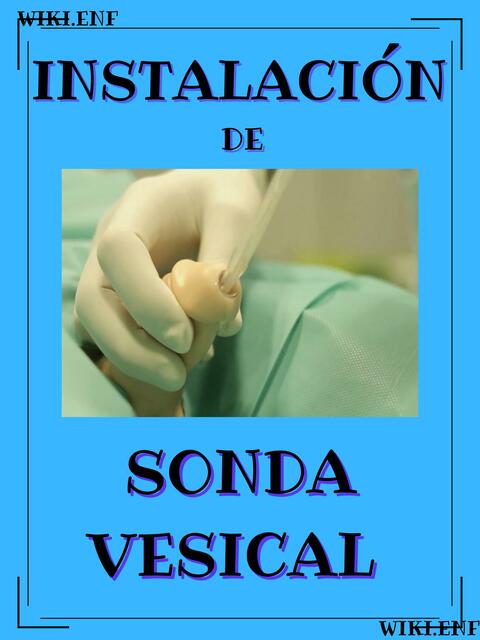 Instalación de Sonda Vesical Masculina