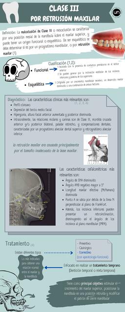 Clases III Por Retrusión Maxilar