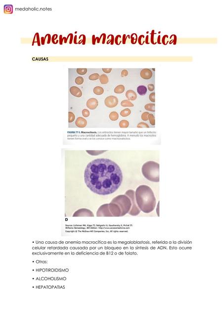 Anemia macrocitica Alessandra uDocz