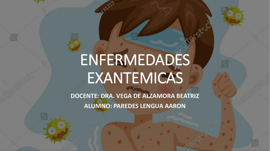 Enfermedades Exantemicas 