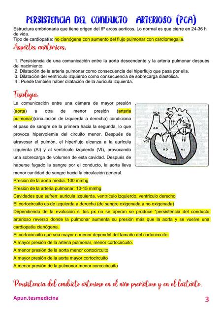 Persistencia del conducto arterioso