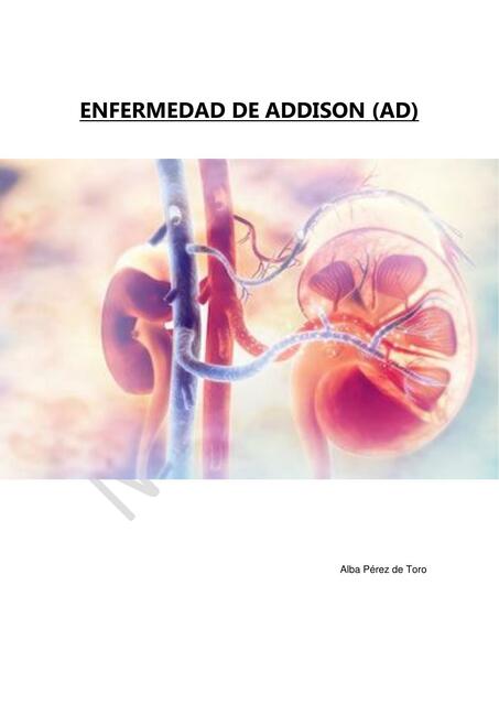 Enfermedad de Addison 