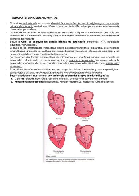 Miocardiopatías