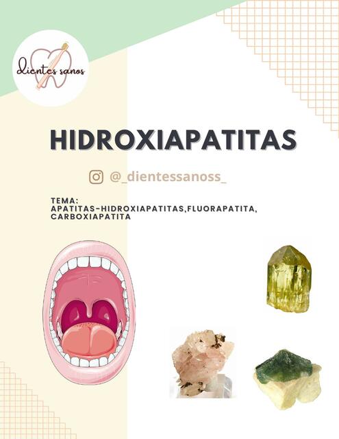 Hidroxiapatitas