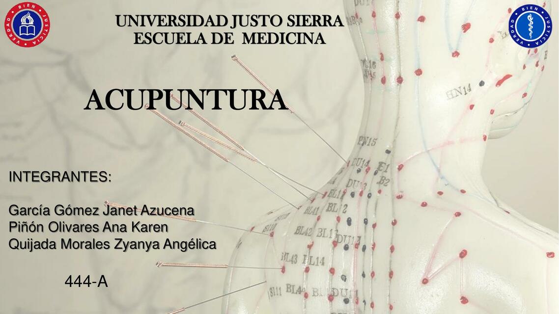 Acupuntura