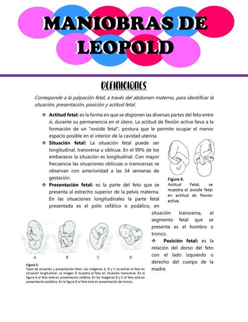 Maniobras de Leopold