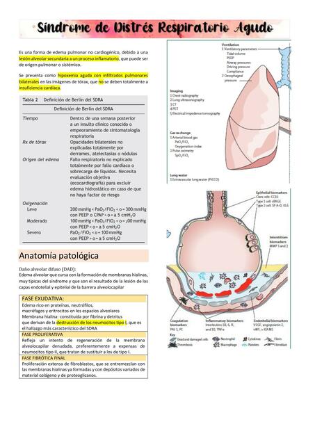 Síndrome de Distrés Respiratorio Agudo