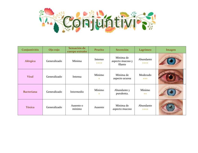 Conjuntivitis 