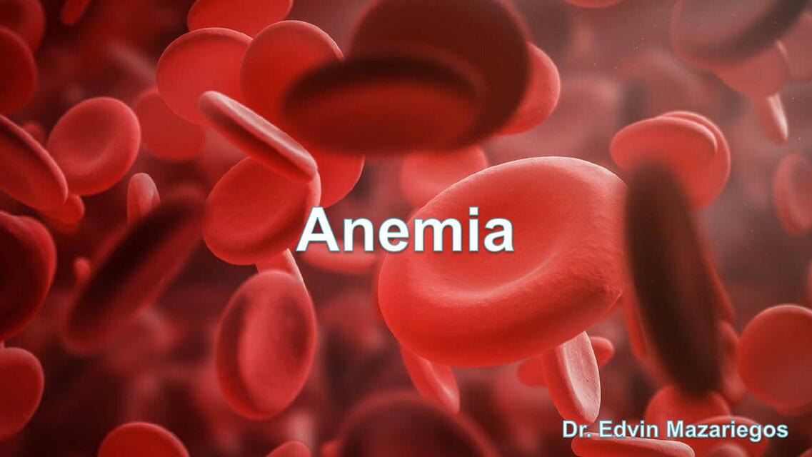 Anemia 