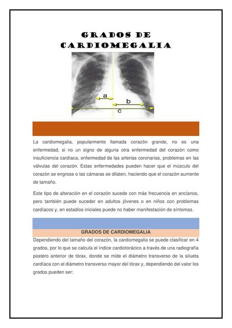 Grados de Cardiomegalia