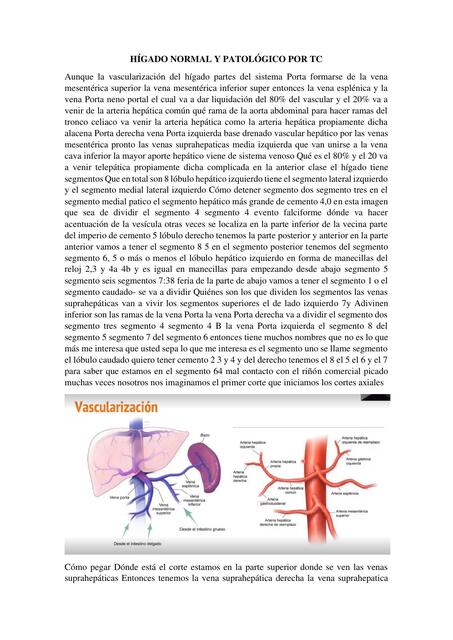 Hígado Normal y Patológico por TC