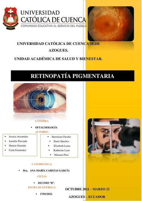 Retinopatía Pigmentaria 