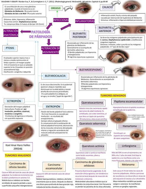 Patología de los Parpados