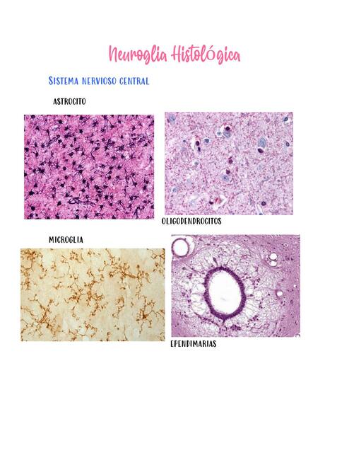 Neuroglia Histológica