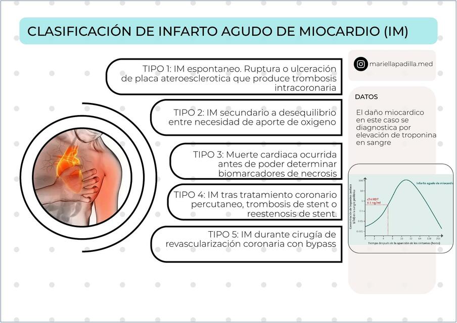 Clasificación de Infarto Agudo de Miocardio