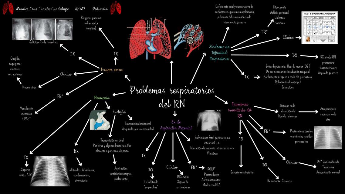 Problemas respiratorios del RN