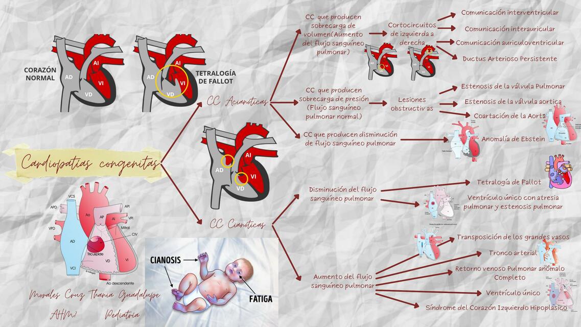 Cardiopatías Congénitas