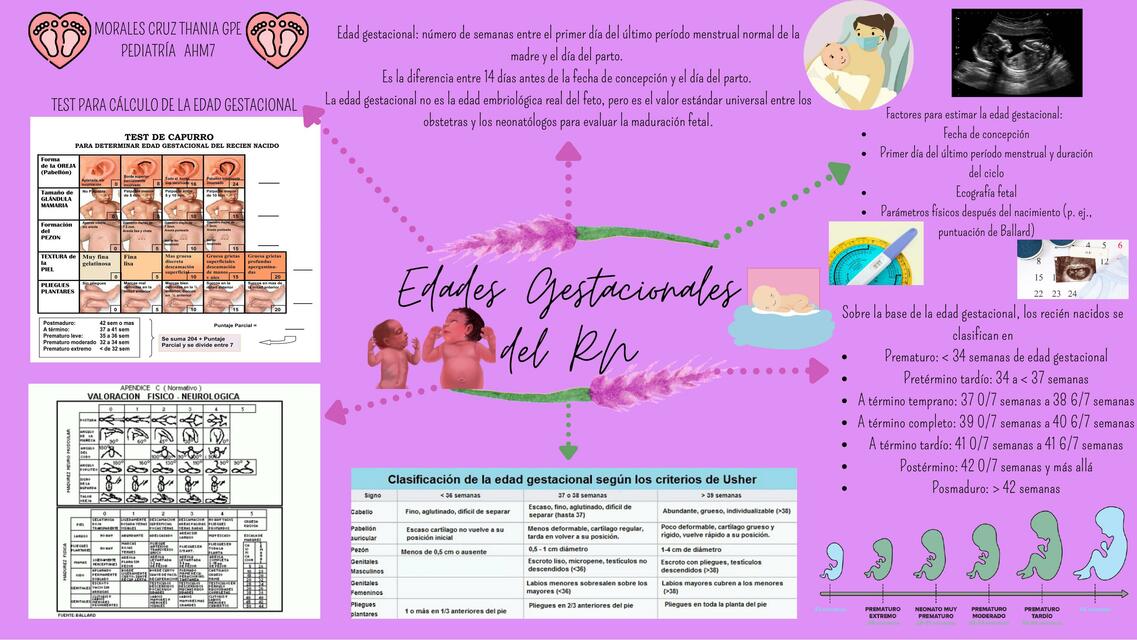 Edades Gestacionales del RN