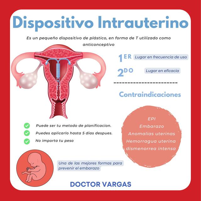 Dispositivos Intrauterinos 