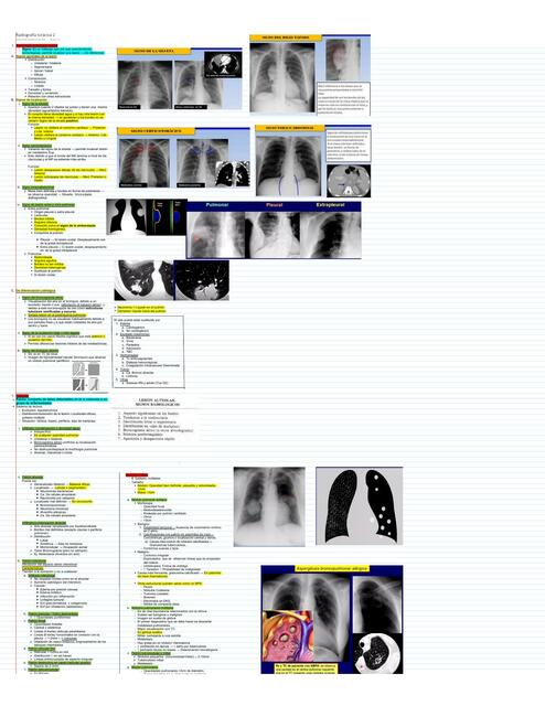 Radiología Pulmonar