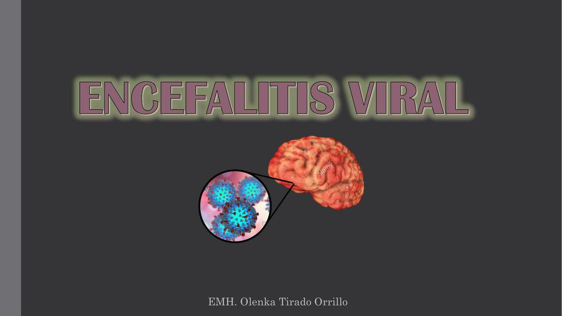 Encefalitis viral