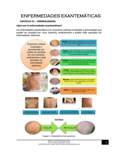 Enfermedades Exantemáticas 