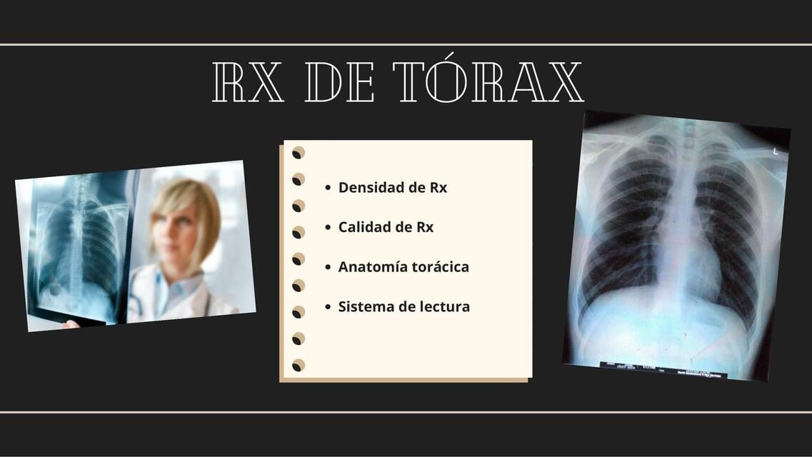 RX de Tórax | Brissa Moreno | uDocz