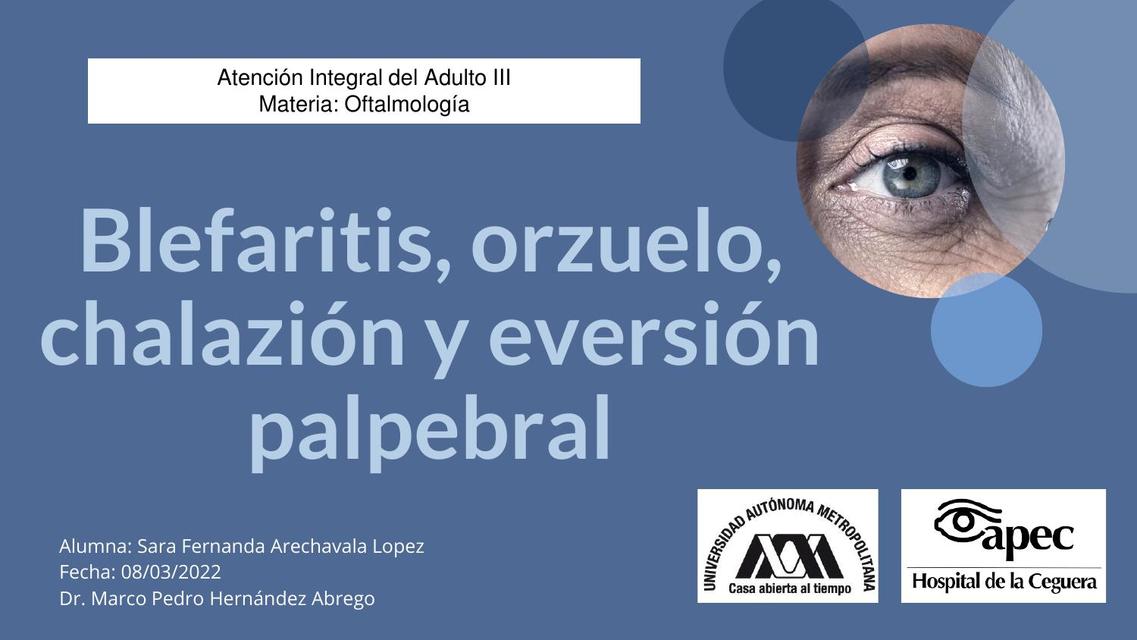 Blefaritis, orzuelo, chalazión y eversión palpebral 