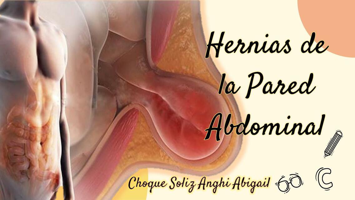 Hernias de la Pared Abdominal 