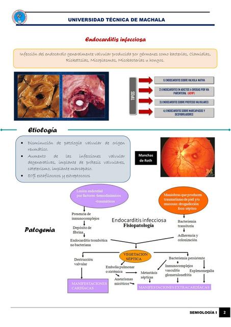 Endocarditis infecciosa, Derrame pericárdico y taponamiento cardíaco, HTA