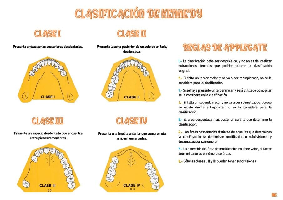 Clasificación de Kennedy | Odontoinfo 📍🦷 | uDocz