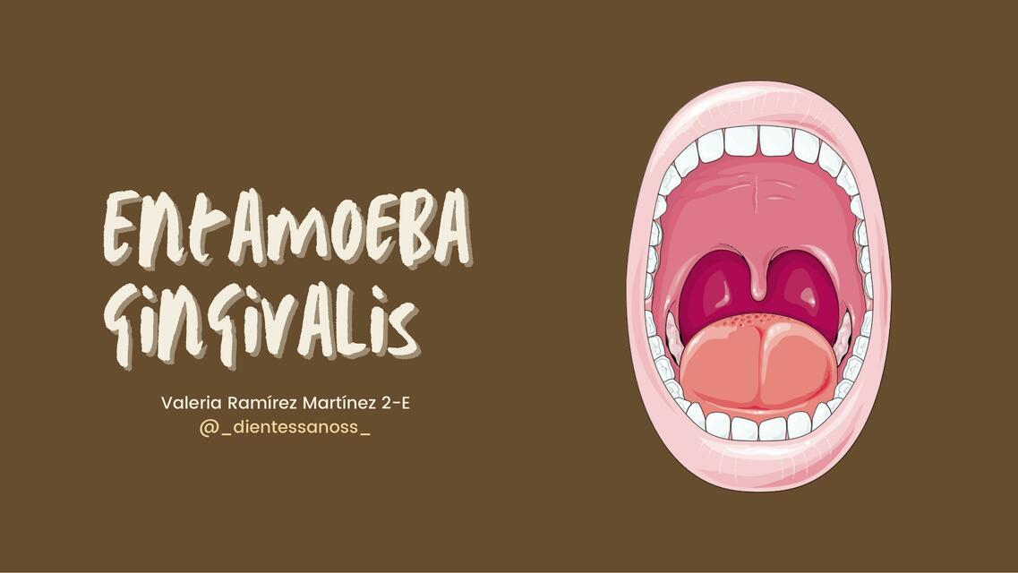 Entamoeba Gingivalis