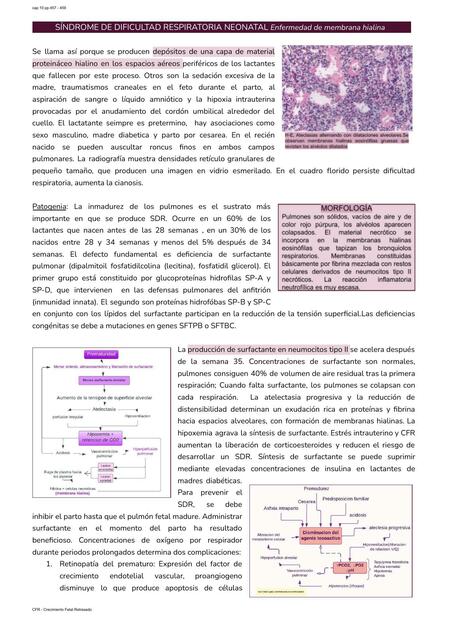 SDRN y  aspiración de meconio