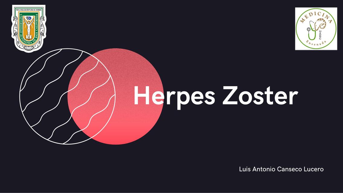 Herpes Zoster