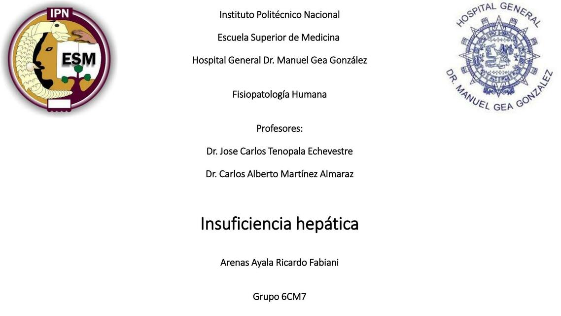 Insuficiencia Hepática