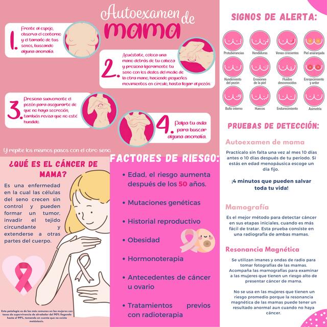 Cancer de mama