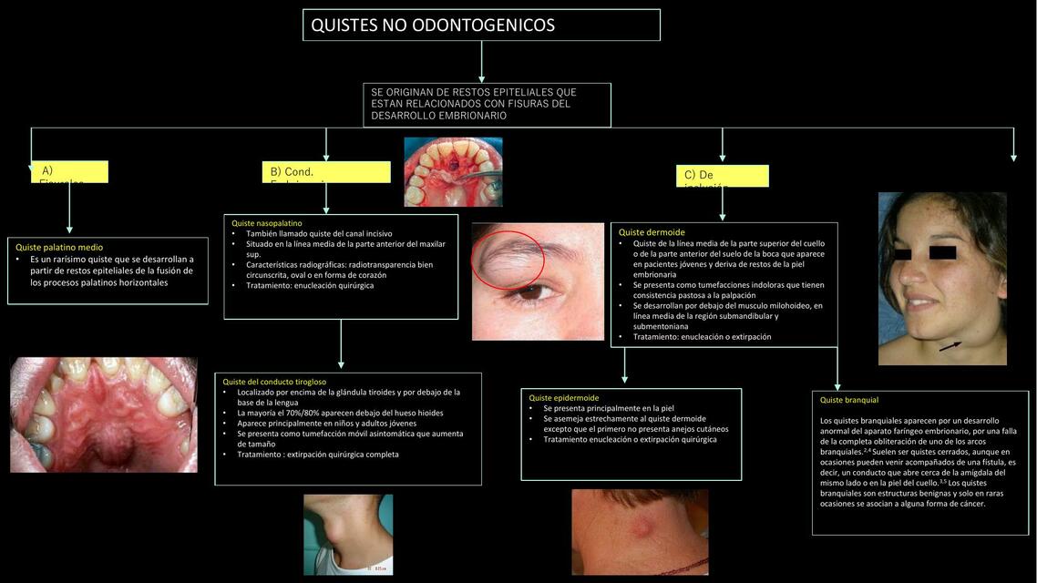 Patología quistes