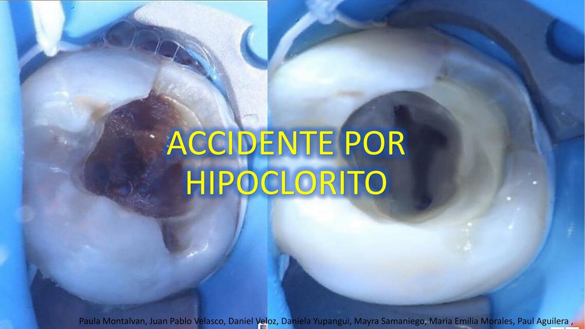 Accidente con Hipoclorito | Paula Montalvan | uDocz