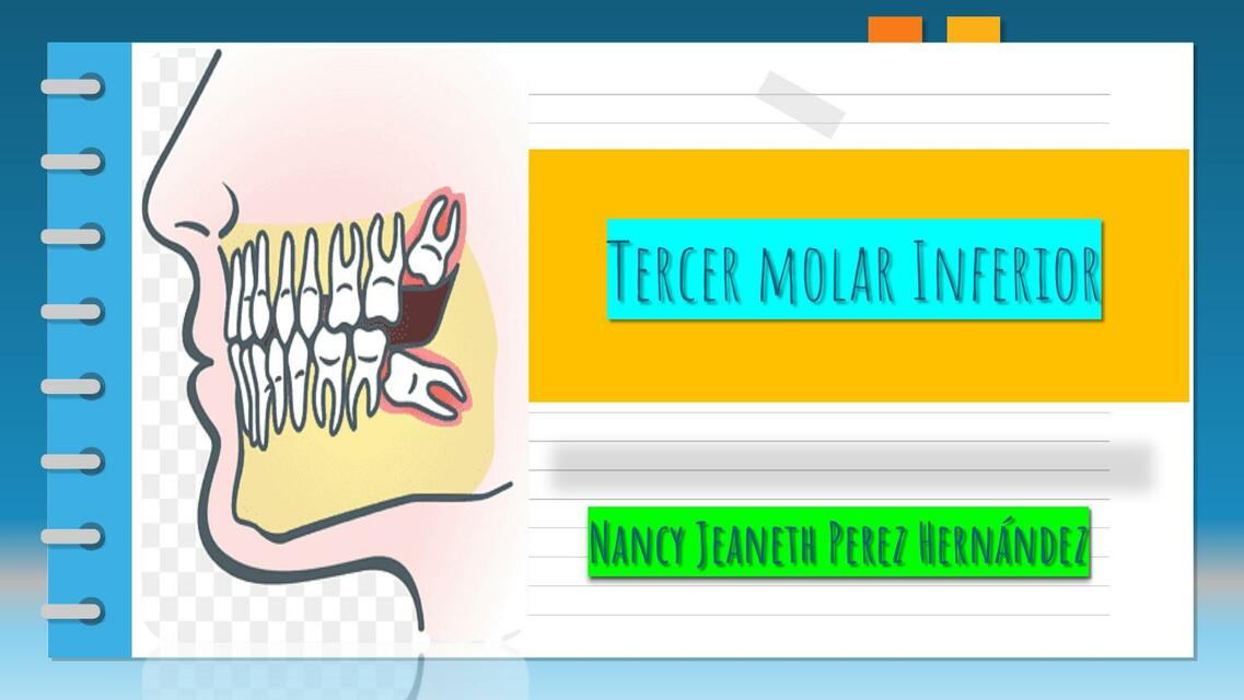 Tercer molar inferior derecho 