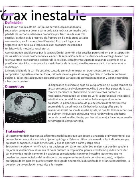 Tórax inestable