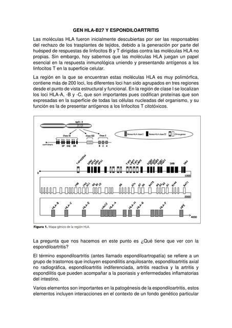 Gen HLA y espondiloartritis