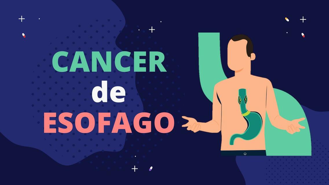 Cáncer de Esófago