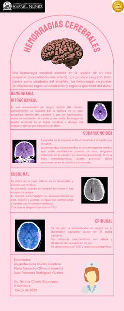 Hemorragias Cerebrales 