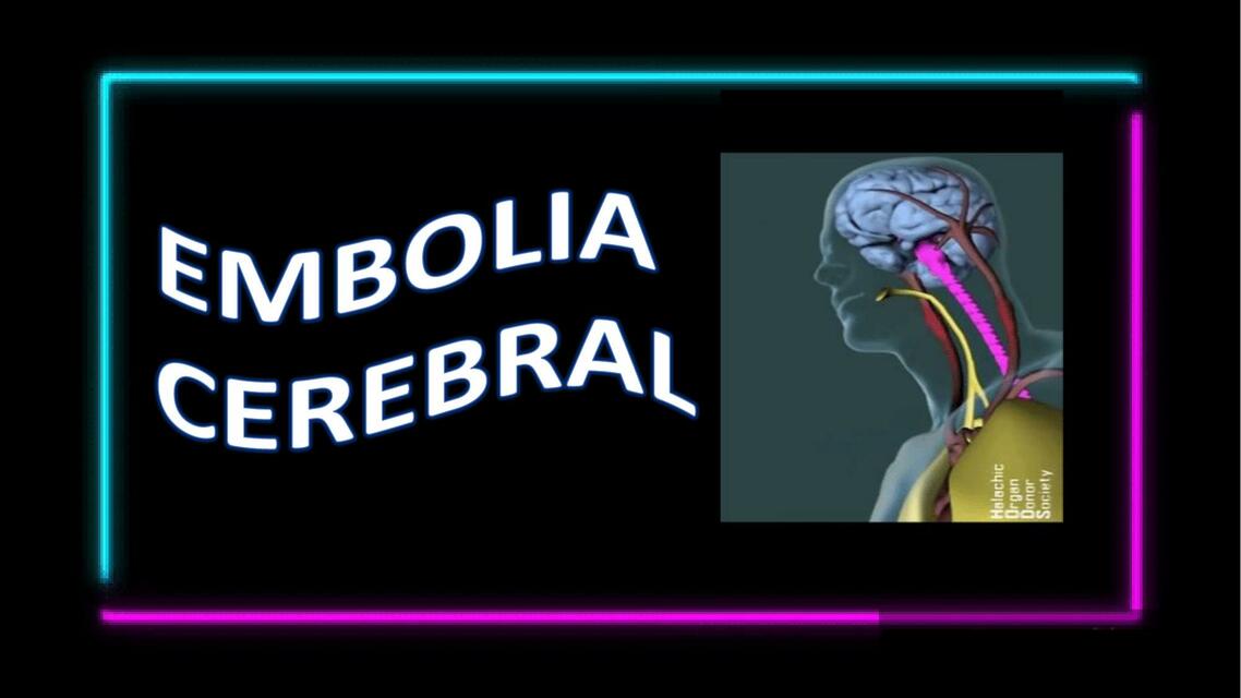 Embolia cerebral