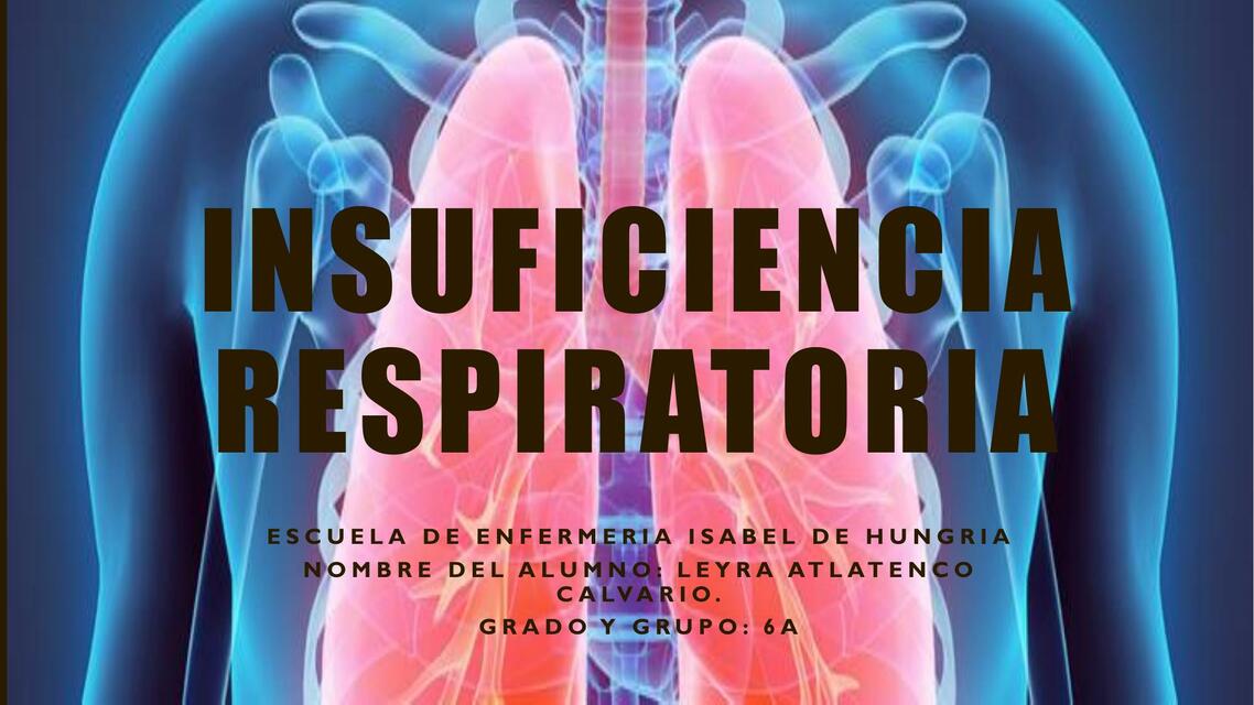 Insuficiencia respiratoria