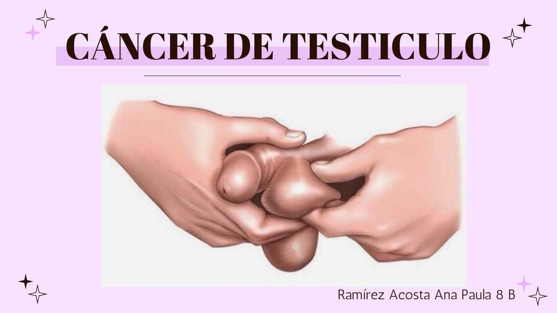 Cáncer de Testículo 